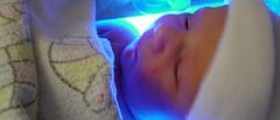 Prevention of jaundice in newborns