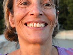 Prevention of periodontal disease