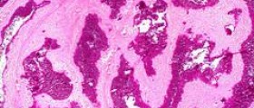 Prevention of renal failure