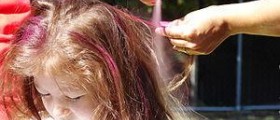 Prevention of tinea capitis