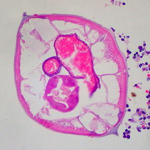 Prevention of worms in humans