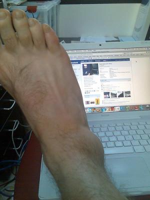 Problem with pain in ankle