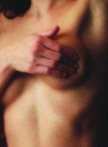 Procedure for breast reduction surgery