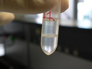 Protein in urine symptoms