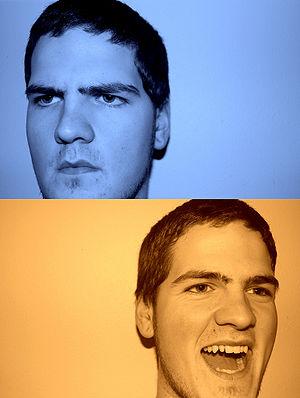 Role of psychiatrist in recognizing and treating bipolar disorder