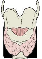Radiation therapy for graves disease