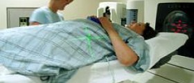Radiation therapy for tumors