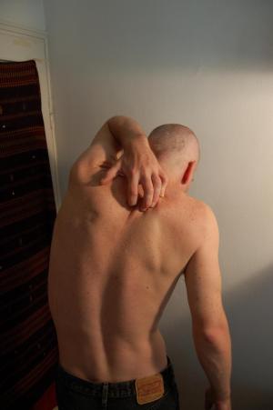 Red itchy scalp