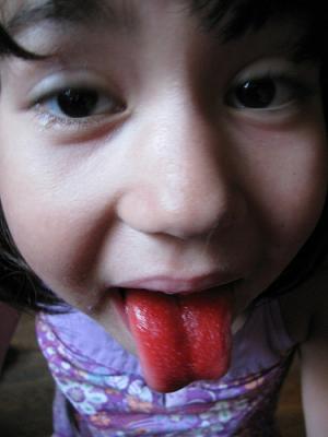 Red tongue causes