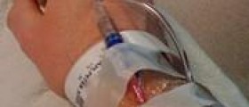 Reduce swelling after surgery