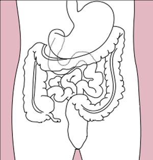 Risk factors for stomach cancer