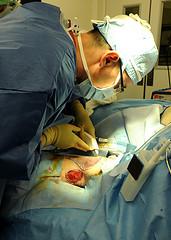 Risks of the skin graft surgery