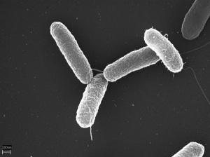 Salmonella poisoning review