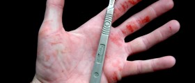 Seven Extreme Cases Of Medical Self-Treatment