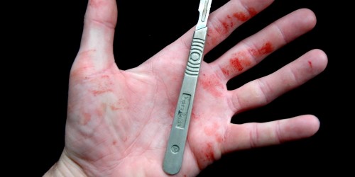 Seven Extreme Cases Of Medical Self-Treatment