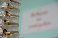 Sciatic nerve pain