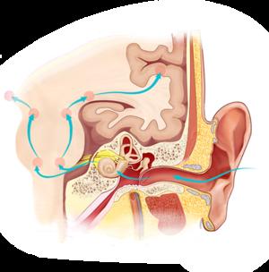 Sensorineural deafness causes