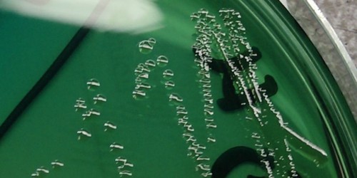 What Is Shigellosis? Basic Info, Symptoms, Diagnosis, Treatment