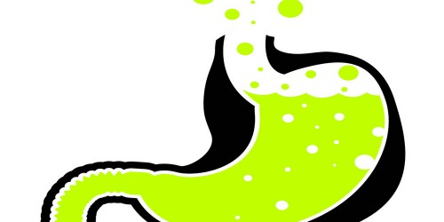 Make lifestyle changes for better control of acid reflux.