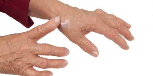 Managing The Pain Of Rheumatoid Arthritis