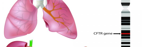Living with Cystic Fibrosis