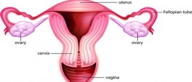 Tubal ligation side effects