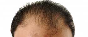 Scientists Discover How To Regenerate Hair And Skin