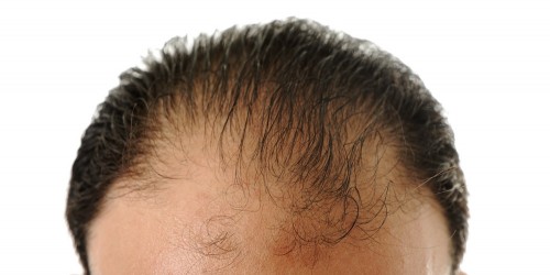 Scientists Discover How To Regenerate Hair And Skin