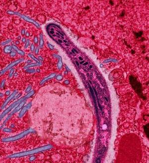 Sickle cell and malaria