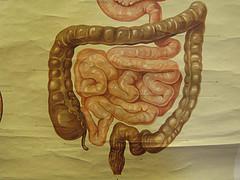 Sickness - Crohn's disease