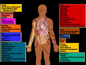 Sickness - cystic fibrosis