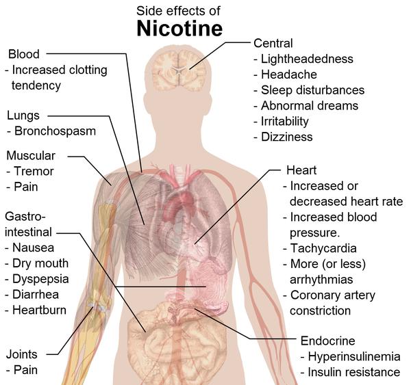 Side effects of facet joint injections