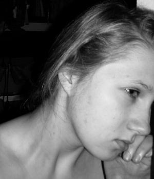 Side effects of Pizotifen