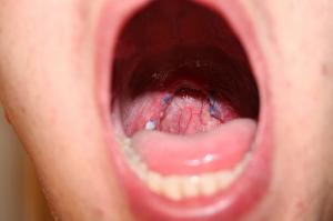 drainage-in-the-back-of-the-throat-breasts-teen-age-girls