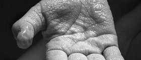 Skin care and wrinkle prevention