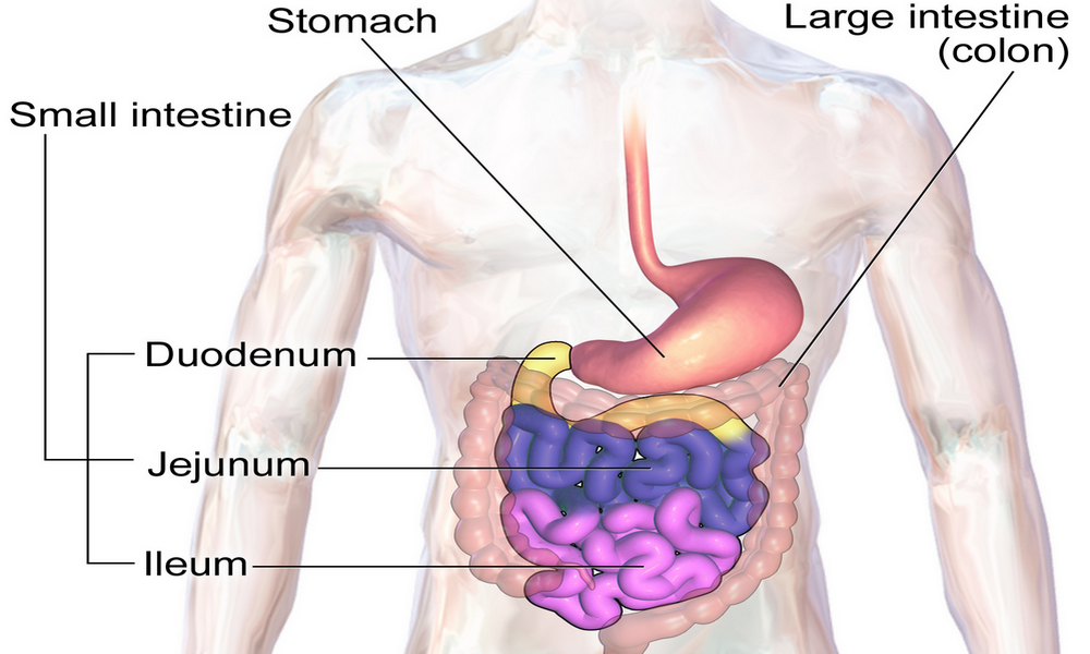 Bowel Obstruction - Several Disorders Are Known To Cause ...