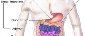 Bowel Obstruction - Several Disorders Are Known To Cause This Disorder