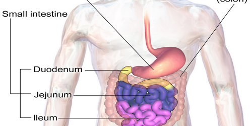 Bowel Obstruction - Several Disorders Are Known To Cause This Disorder