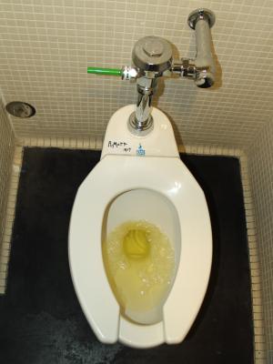 Smelly urine in men