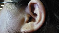 Some deafness facts