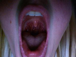 Soothe a sore throat