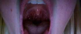 Soothe a sore throat