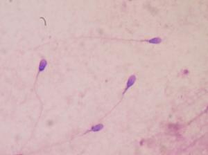 Sperm count - various facets