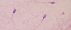 Sperm count - various facets