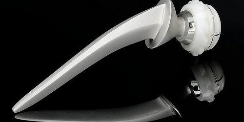 A New Way To Get A New Hip