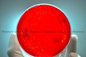Staphylococcus bacteria information