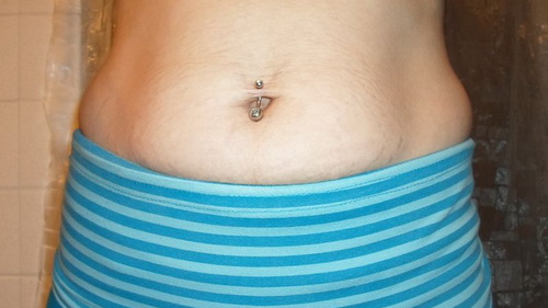 how can i minimize the appearance of stretch marks how can i minimize the appearance of stretch marks