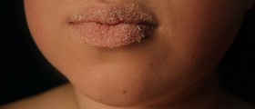 Does Eating Sugar Age Your Skin?