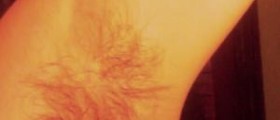 Swollen armpit glands