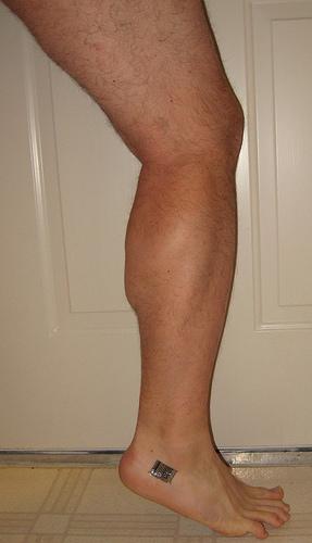 swollen-calf-muscle-general-center-steadyhealth